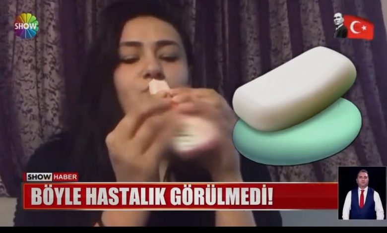 شاهد بالفيديو فتاة في تركيا تأكل الصابون منذ 15 عام !!..تعرف على السبب..؟